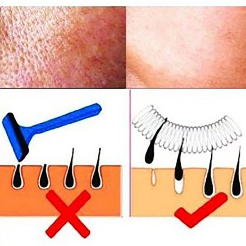 Facial Hair Remover O606293